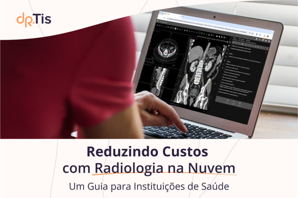 Reduzindo Custos com Radiologia na Nuvem - Blog